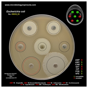 non-ESBL E.coli