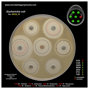 non-ESBL E.coli