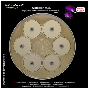 non-ESBL E.coli