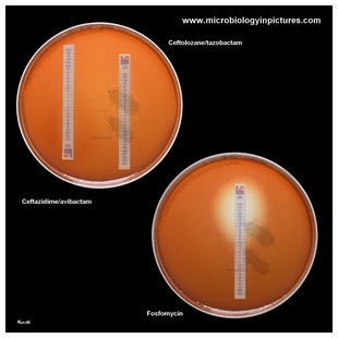 p.aeruginosa antibiotic testing