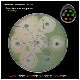 p.aeruginosa antibiotic testing