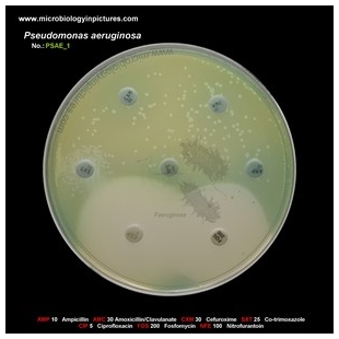 p.aeruginosa antibiotic testing