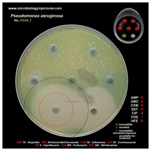 p.aeruginosa antibiotic testing