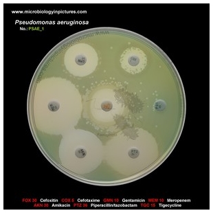 p.aeruginosa antibiotic testing