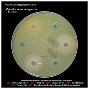 p.aeruginosa antibiotic testing