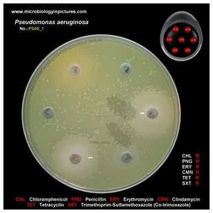 p.aeruginosa antibiotic testing