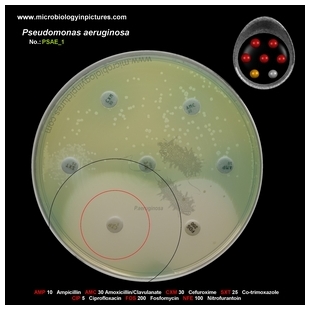 p.aeruginosa antibiotic testing