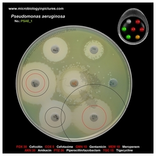 p.aeruginosa antibiotic testing