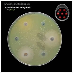 p.aeruginosa antibiotic testing