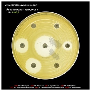 p.aeruginosa antibiotic testing
