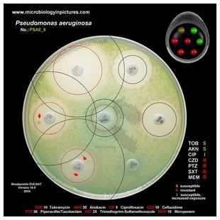 p.aeruginosa antibiotic testing