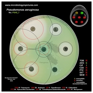 p.aeruginosa antibiotic testing