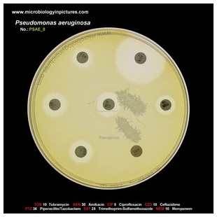 p.aeruginosa antibiotic testing