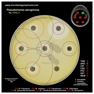 p.aeruginosa antibiotic testing