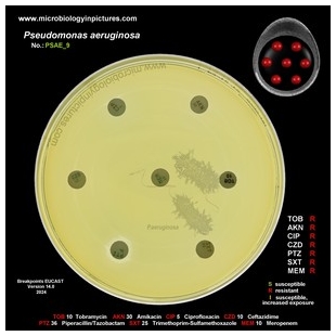 p.aeruginosa antibiotic testing