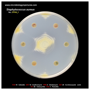 s.aureus antibiogram 1