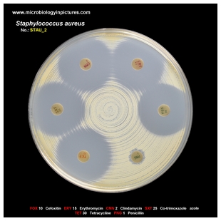 s.aureus antibiogram 2