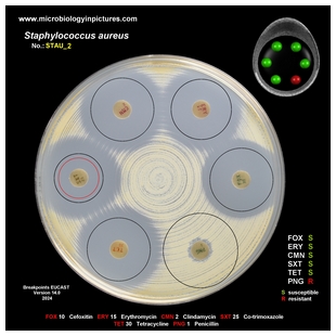 s.aureus antibiogram 2 breakpoints