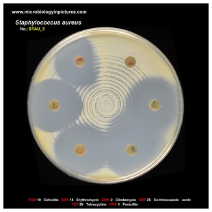 s.aureus antibiogram 3