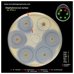 s.aureus antibiogram 3 breakpoints