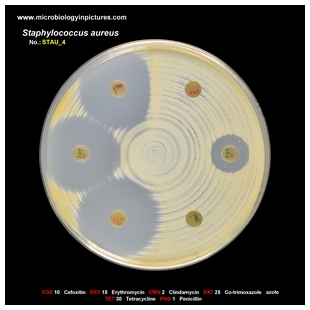 s.aureus antibiogram 4