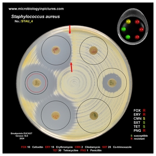 s.aureus antibiogram 4 breakpoints