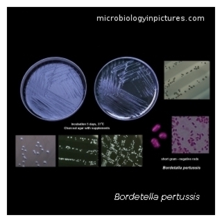 Бордетелла пертусис. Бордетелла пертуссис. Bordetella pertussis антибиотики. Bordetella pertussis колонии. Bordetella pertussis микробиология.