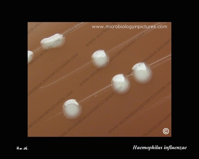 Haemophilus influenzae virulent strain. Colony morphology of a virulent ...