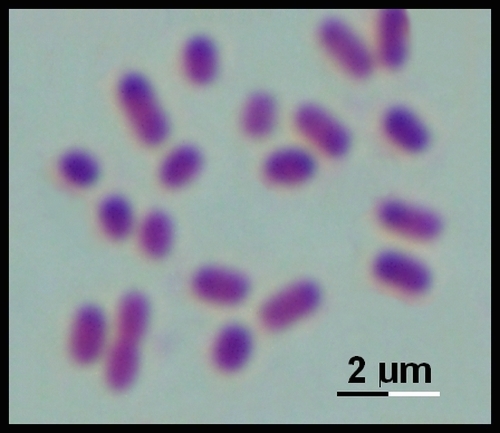haemophilus ducreyi gram stain