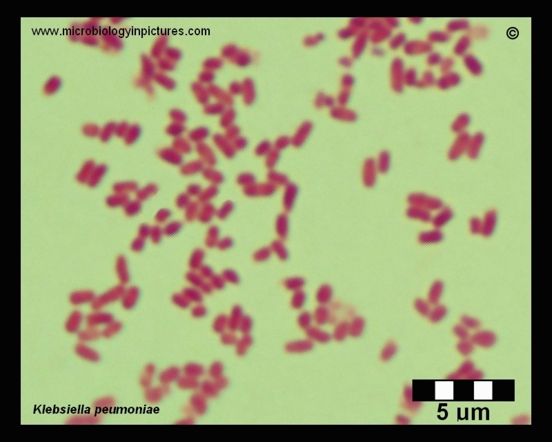 klebsiella pneumoniae capsule stain