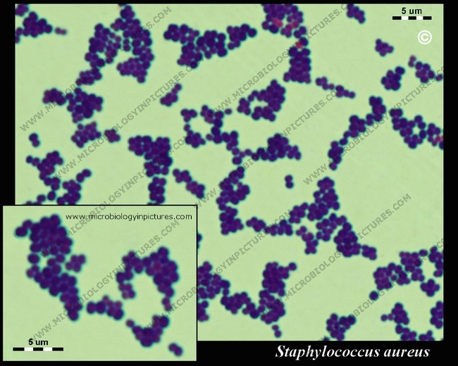 Staphylococcus aureus under microscope: microscopy of Gram-positive cocci,  morphology and microscopic appearance of Staphylococcus aureus, S.aureus  gram stain and colony morphology on agar, clinical significance