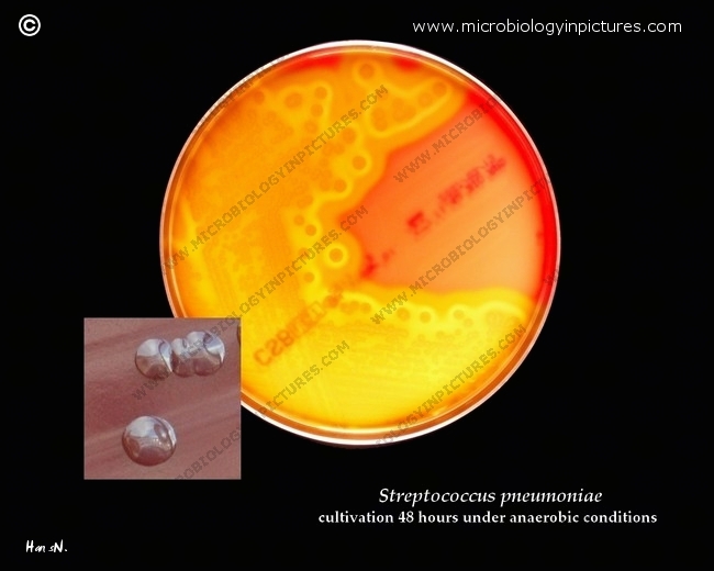 Pneumococci cultivated anaerobically on blood agar. Colonies of ...