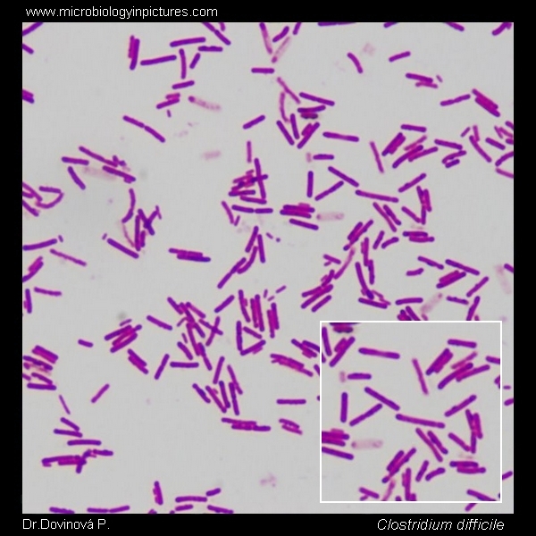 gram stain microscopic morphology