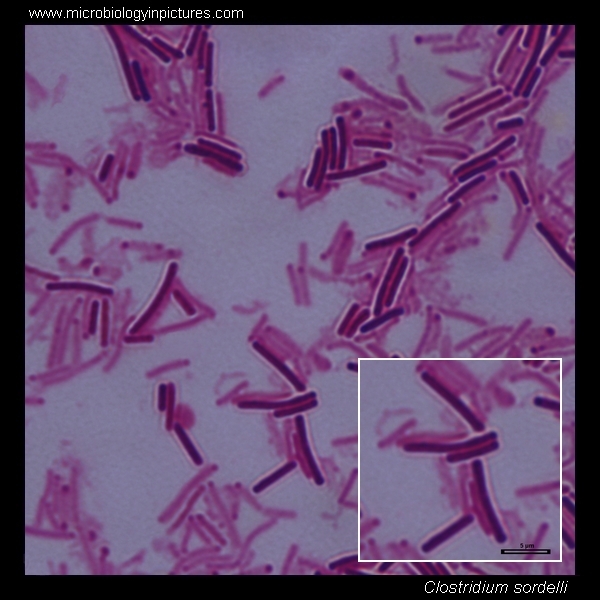 clostridium sordelli micrograph