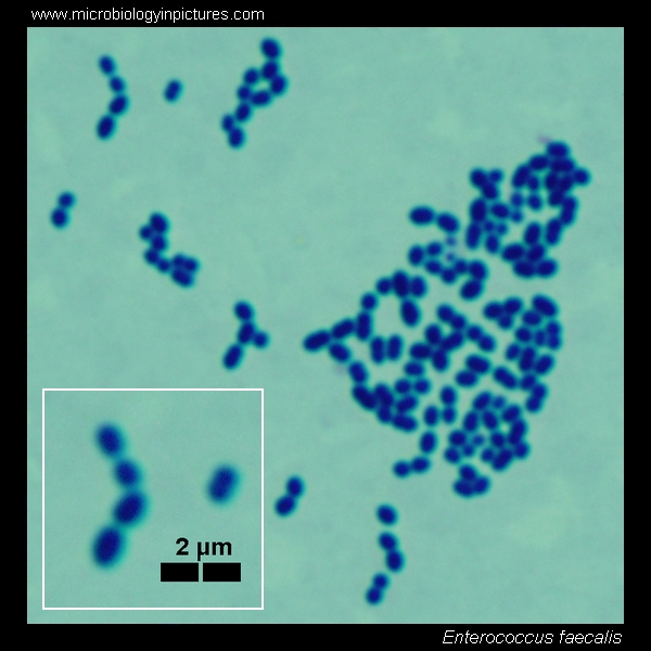 streptococcus faecalis