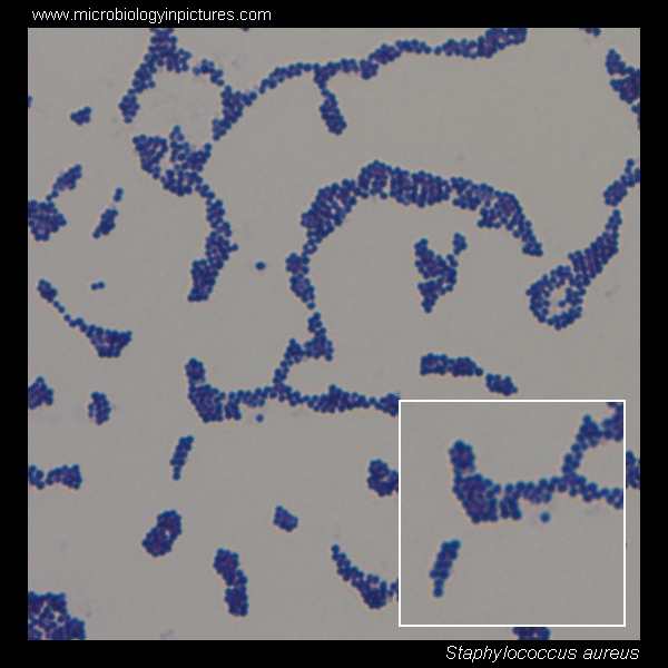 Staphylococcus aureus morphology visualised using Gram staining (10×