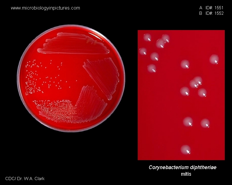 Corynebacterium diphtheriae фото