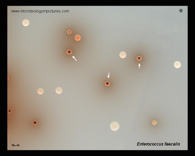 colonies of enterococci and esculin non-hydrolyzing bacteria