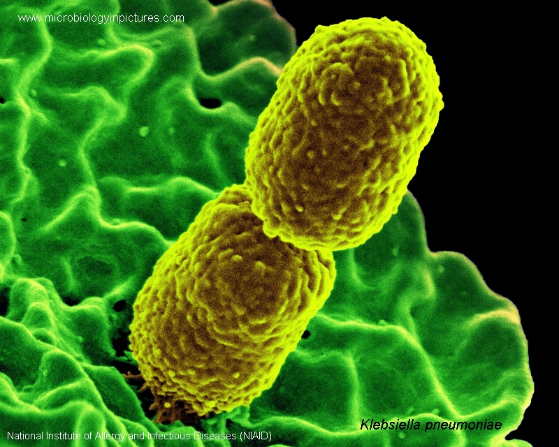 klebsiella pneumoniae interacting with a neutrophil