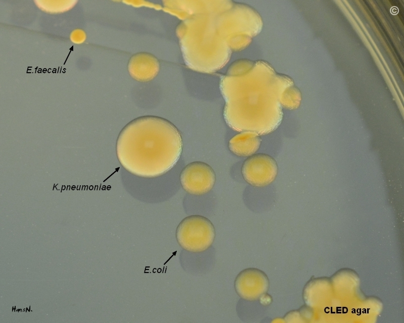 Klebsiella Pneumoniae On Cled Agar