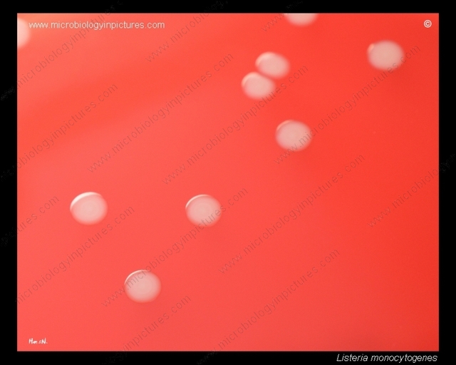 listeria monocytogenes morphology on blood agar