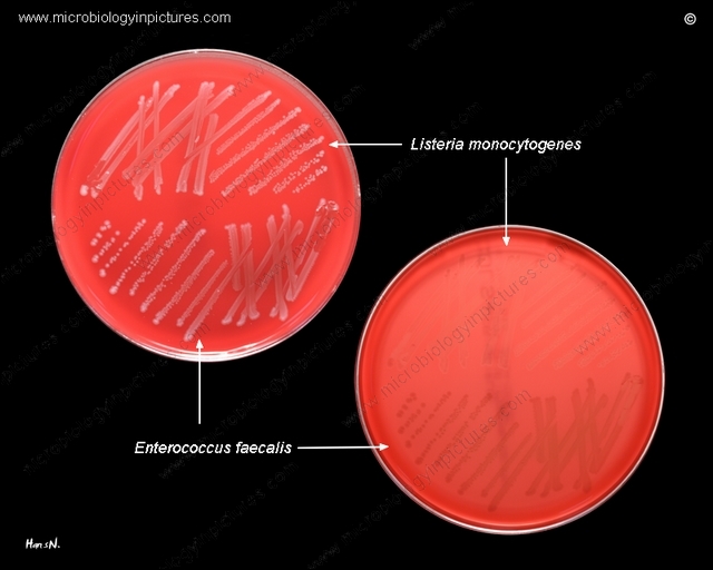 l.monocytogenes and e.faecalis on blood agar, appearance