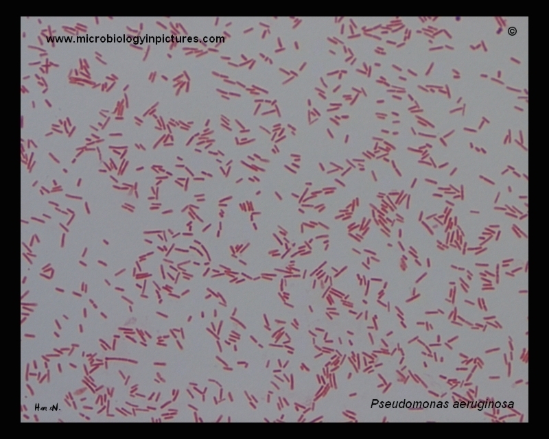 pseudomonas fluorescensgram stain