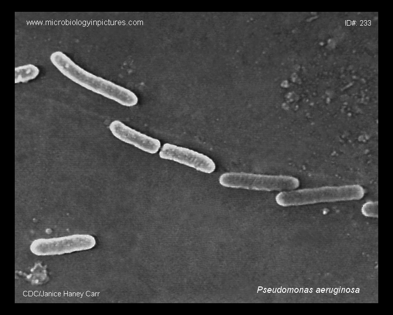 pseudomonas bacteria