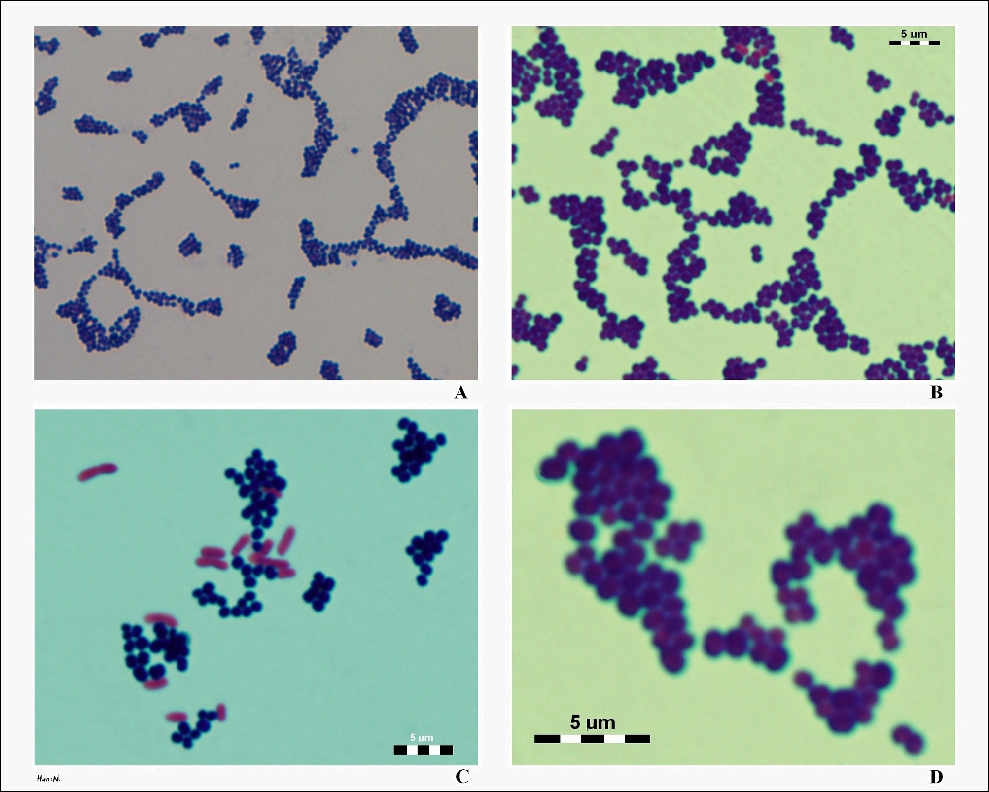 https://www.microbiologyinpictures.com/bacteria-photos/staphylococcus-aureus-photos/s_aureus_under_microscope.jpg