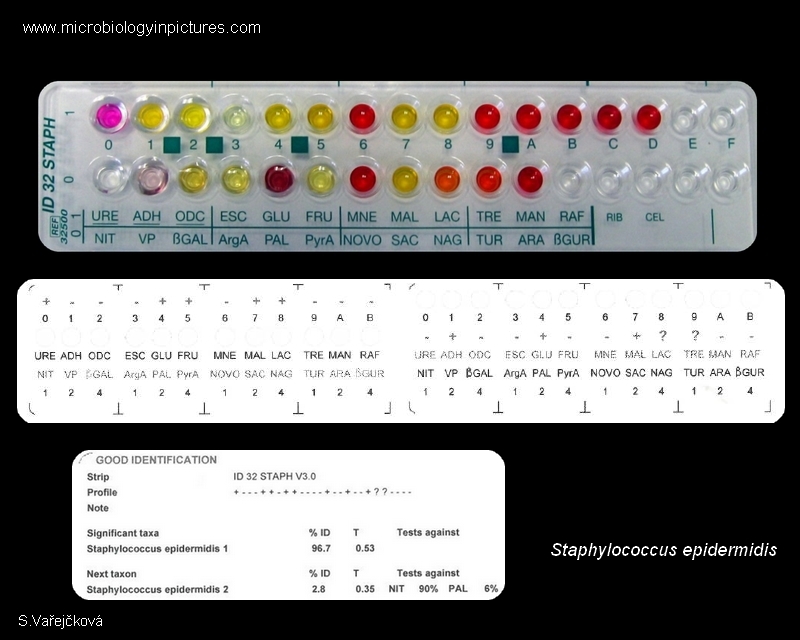 s.epidermidis identification