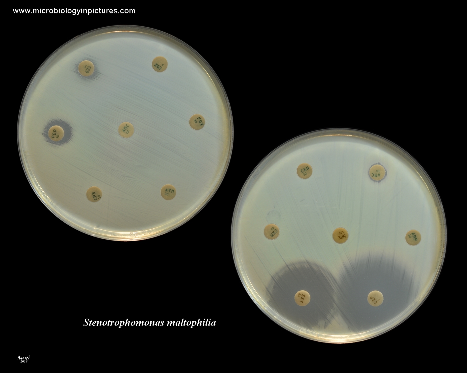 Stenotrophomonas Maltophilia Antibiotic Susceptibility Testing With The   Stenotrophomonas Maltophilia 13 