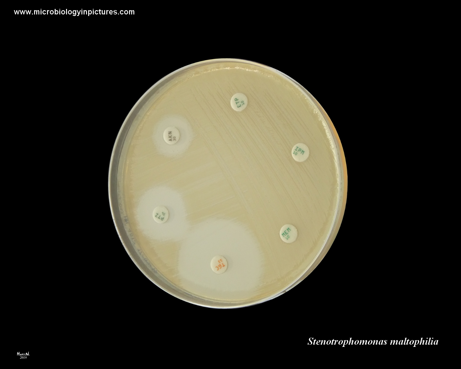 Stenotrophomonas Maltophilia Resistance To Carbapenems And Other   Stenotrophomonas Maltophilia 14 