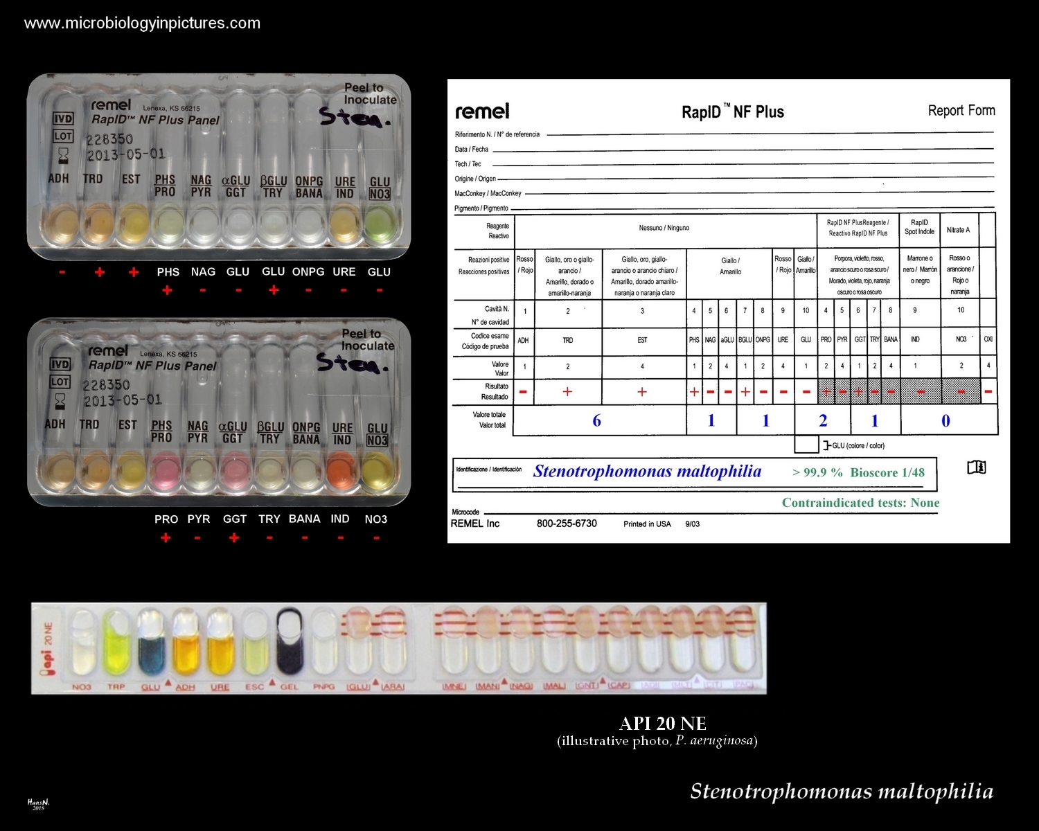 Stenotrophomonas maltophilia identification with the RapID NF Plus ...