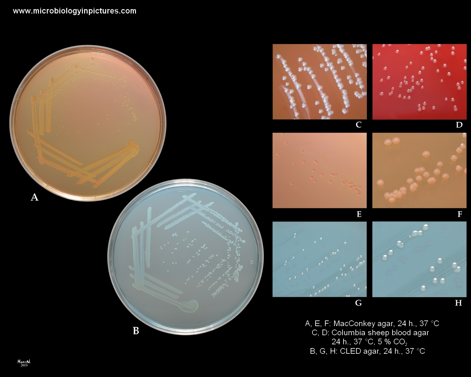 Stenotrophomonas Maltophilia Colony Morphology On Various Cultivation   Stenotrophomonas Maltophilia 2 